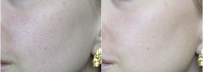Дневной крем с тонирующим эффектом Estee Lauder DayWear Multi-Protection Antioxidant Sheer Tint Release Moisturizer SPF15