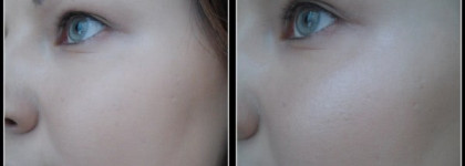 МАСи на моем поле