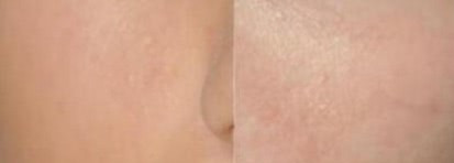 Встречайте: Guerlain Lingerie de Peau Foundation and Concealer Compact