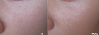 Тонирующий крем Christian Dior - Hydra Life Pro-Youth Skin Tint SPF 20