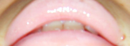 Любимый блеск для губ Artdeco Hydra Lip Booster