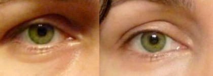 Маскирующее средство NoUba Touch - не самый лучший выбор