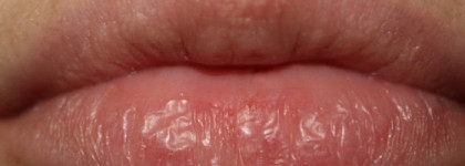 Shiseido The Skincare Protective Lip Conditioner SPF 10 – Защитный бальзам для губ