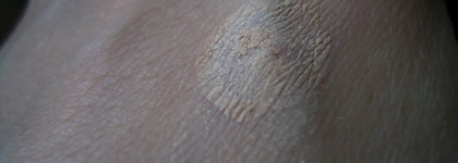 Fresh Look Drying Lotion. Средство для борьбы с "подкожниками"