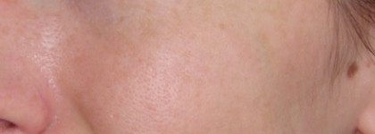 Мой компактный фотошоп: La Roche-Posay Toleriane Teint Mineral Compact-Powder Complexion Corrector Spf25 (11)