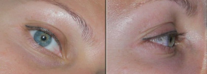 Маски для глаз - какую выбрать