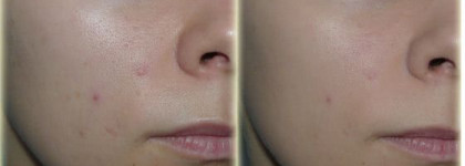 Clarins Fond de Teint Lisse Minute — Тональный крем-мусс, выравнивающий цвет лица