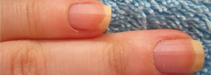 Удаление кутикулы: Frenchi vs Mavala