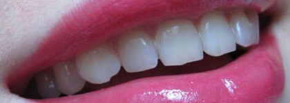 Помада Addict #778 Show от Dior