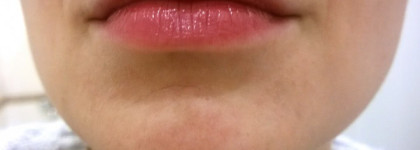 3 омолаживающие сыворотки для лица с витамином С