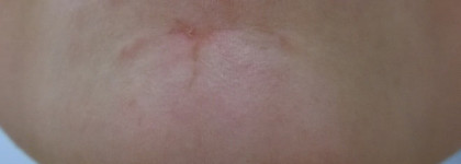 Как изуродовать лицо маской Kiko Peeling Mask