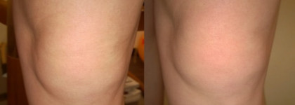 Крем, который реально даёт эффект лифтинга