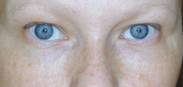 Stress relief маска для кожи вокруг глаз