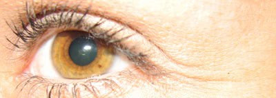 "Рамочка" для "зеркала души" или выбор крема для кожи вокруг глаз