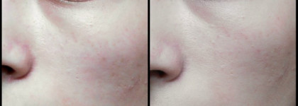 Увлажняющий Bb-Крем Guerlain Super Aqua-Serum BB+ Hydra Beauty Balm Instant Hydration Perfects SPF 25 PA++ в оттенке Clair/Light