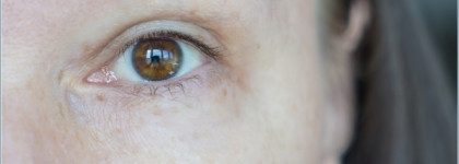 Два месяца с Clarins Total Eye-Lift Lift replenishing eye concentrate ("до" и "после")