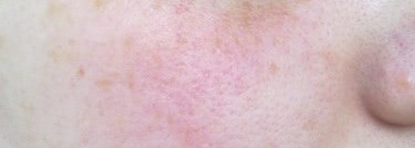 Shiseido The Makeup Stick Foundation SPF 15 № I00