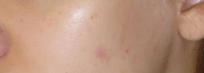 Волшебник из белоснежной баночки - Filorga Sleep and Peel ночной разглаживающий крем