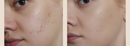 Dior Diorskin Nude Skin-Glowing Make-Up Fluid Foundation SPF 15 в оттенке 021