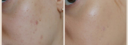 YSL Touche Eclat Radiant Touch №2  &  YSL Le Teint Touche Éclat BD30 Beige Dore