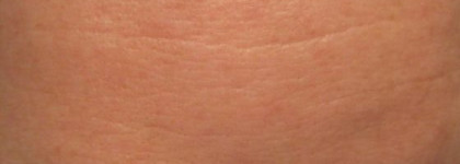 Shiseido Pore Smoothing Corrector_ Корректирующее средство для уменьшения видимости пор