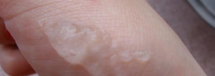 Бюджетное очищение моей комбинированной кожи