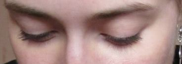 Проблемная кожа: уход и лечение