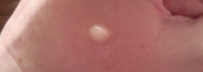 Shiseido The Skincare Eye Moisture Recharge - Увлажняющее тонизирующее средство для кожи вокруг глаз