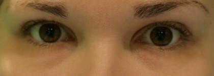 Обрамление "Зеркала души" при помощи GIGI-CollagenElastin Eye Gel (Геля для век)