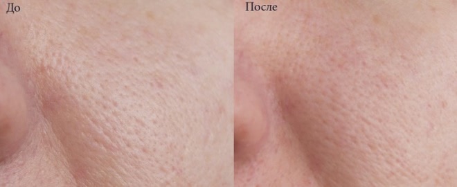 Грязевая маска для лица Rivage Facial Mud Mask
