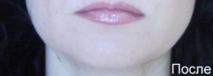 Estee Lauder Resilience Lift Exstreme. Лосьон, максимально повышающий упругость кожи