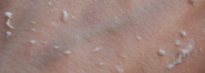 Secret Key Lemon Sparkling Peeling Gel - Пилинг-скатка лимонная