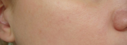 Смотрю в зубы даренному коню, Rimmel London Renew & Lift Foundation, тон № 101 Porcelain