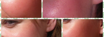 Совершенно летние румяна Сhanel Joues Contraste Powder Blush #82 Reflex и Benefit Coralista a «rio» pleasure ... face powder