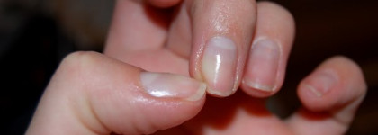 Реабилитация ногтей и  про лаки