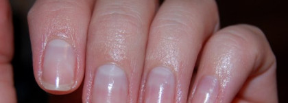 Реабилитация ногтей и  про лаки