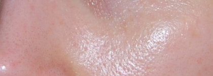 Уход за кожей лица. Пост второй