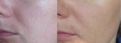 Luminous touch Легкий тональный крем с эффектом сияния от Lumene оттенок № 3