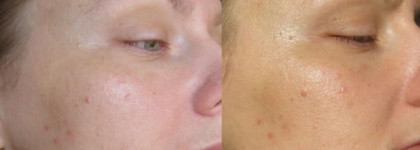 Skinfood- любовь моя, часть 1, декоративная