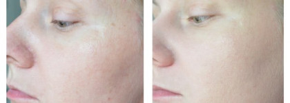 Clinique Superdefense CC cream Spf30 Very Light