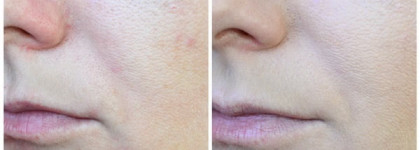 Konad iloje Flobu Capsule CC Cream, Iloje Flobu Blemish Balm BB Cream