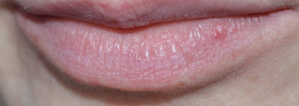 Beautydrugs Lip Calm, Lip Scrub, Micro Matic Taupe,Twin Lights