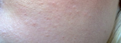 Сравнение двух умывалок: Vichy Normaderm и Clinique Liquid Facial Soap Oily Formula