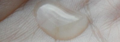 Pevonia Botanica Ligne Rose RS2 Concentrate - Концентрат RS2  Певония Ботаника