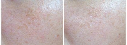 Almea: CC-cream и Xlips