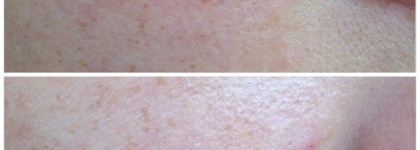 Almea: CC-cream и Xlips