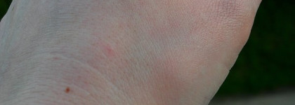 Еще немного о Дарфан (результат моего похода к косметологу Дарфан)