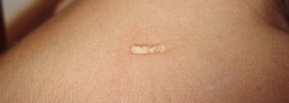 Ролик, гель и крем для ухода за кожей вокруг глаз