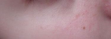 Lancome Teint Miracle # 02 Lys Rose