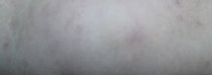 Маскирующий карандаш Clinique Anti-Blemish Solutions Сlearing Сoncealer